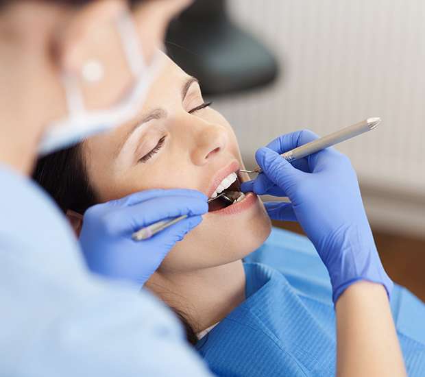 Santa Clara Dental Restorations