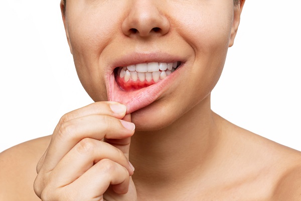 How A General Dentist Treats Gum Disease