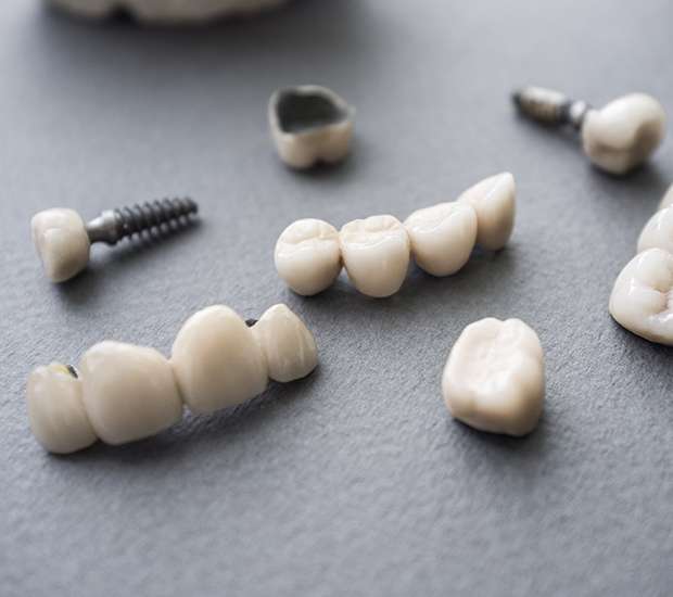 Santa Clara The Difference Between Dental Implants and Mini Dental Implants