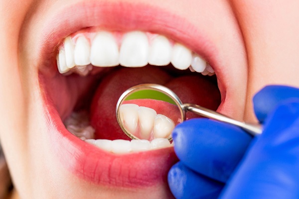 How Preventive Dentistry Can Keep Cavities From Forming
