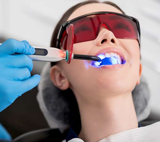 Santa Clara Professional Teeth Whitening