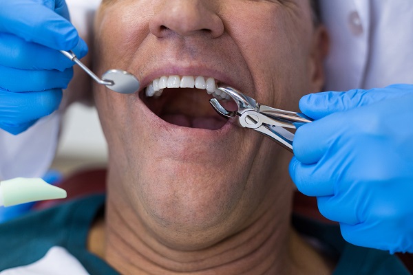 How Long Does It Take To Recover From A Tooth Extraction?